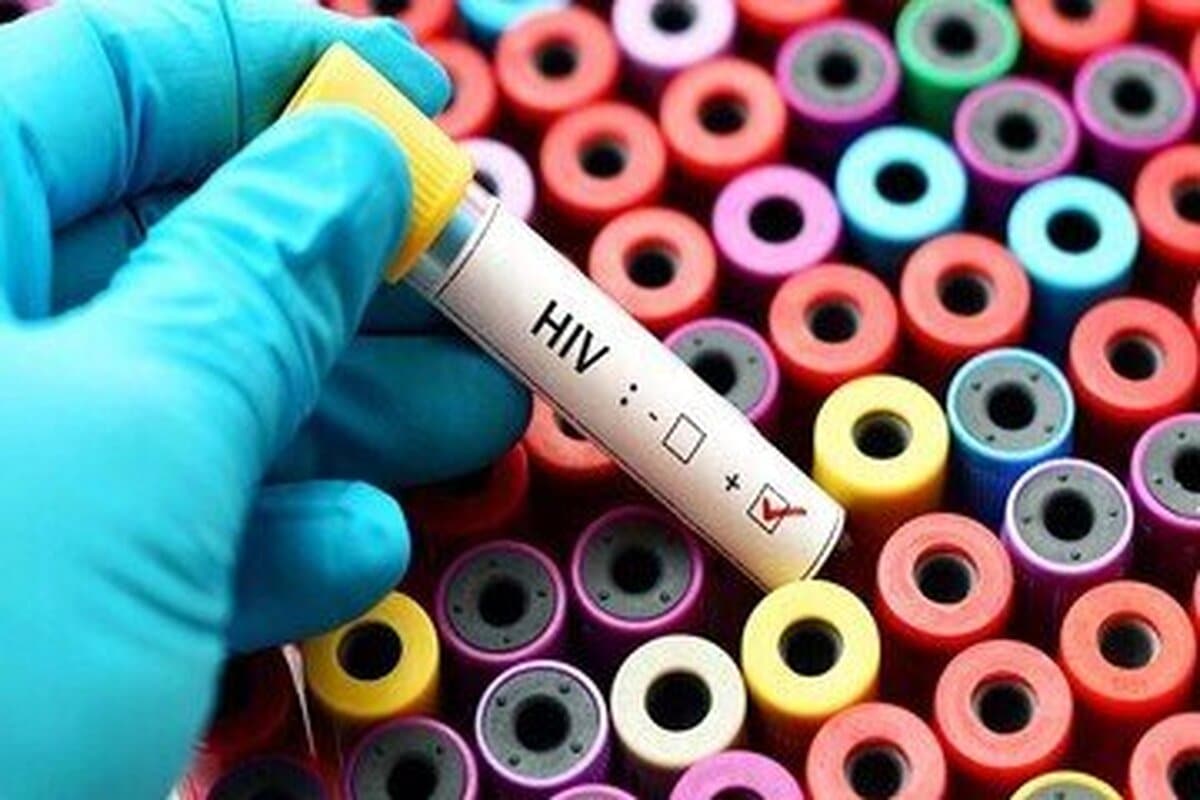 شناسایی ۴۱ هزار مبتلا به HIV در ایران