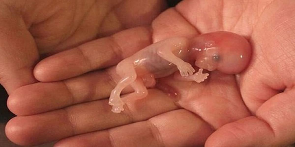 این گونه از سقط خودبه خودی جنین جلوگیری کنید
