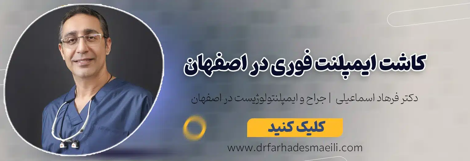 کاشت ایمپلنت فوری در اصفهان