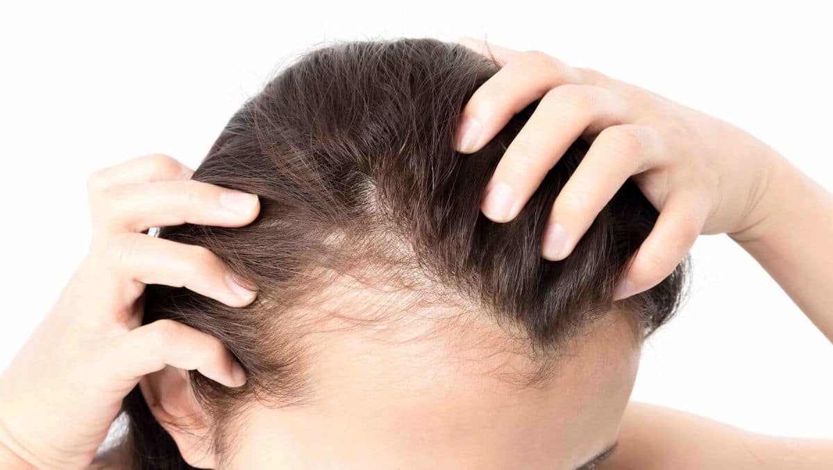 با مصرف این خوراکی ها از ریزش مو جلوگیری کنید