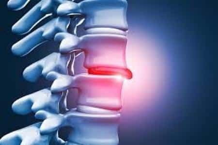 احساس ضعف اندام تحتانی نشانه چیست؟