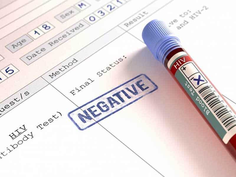 الگوی انتقال ویروس HIV تغییر کرده/ کنترل این بیماری رایگان است؟