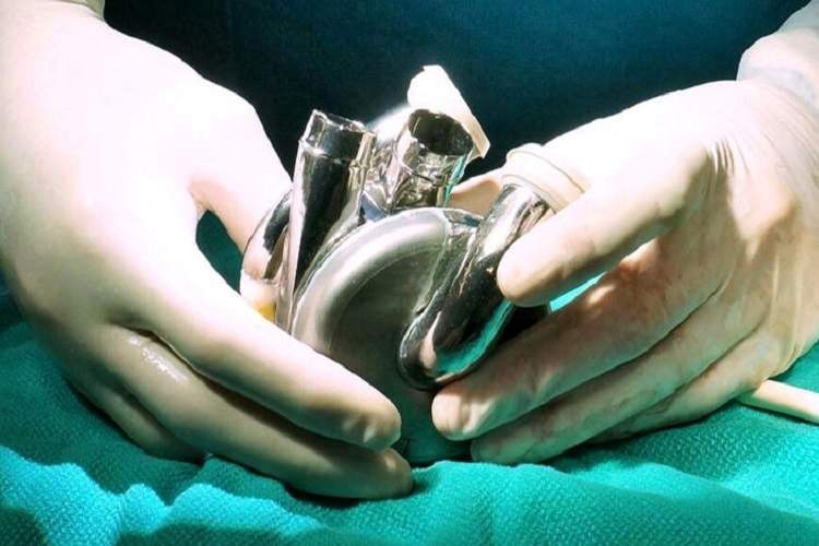 انقلابی در پزشکی: قلب مصنوعی تیتانیومی جان یک مرد را نجات داد