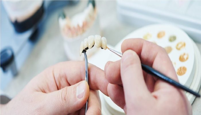 تولید کامپوزیت‌های دندانی با ثبات رنگ بالا