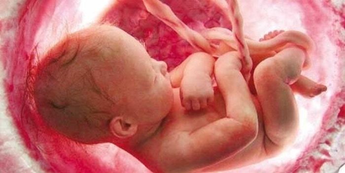وزارت بهداشت خبر تولد ۱۲ نوزاد با سندروم داون را تکذیب کرد